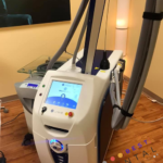 Lumenis Splendor X Laser Hair Removal Machine Best Dental